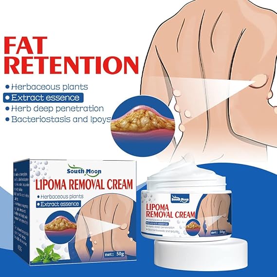 Lipoma Removal Cream | Special Price Offer