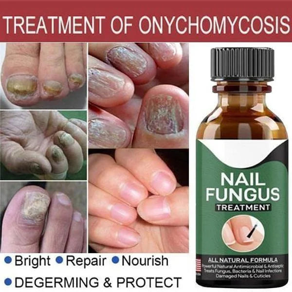 Nail Fungus Serum