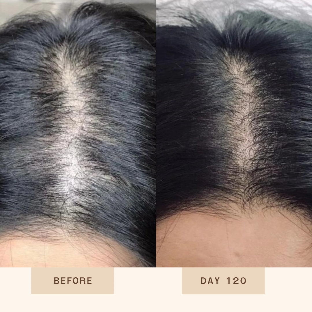 Proskire Anti-Grey Hair Serum | Reduces White Hair