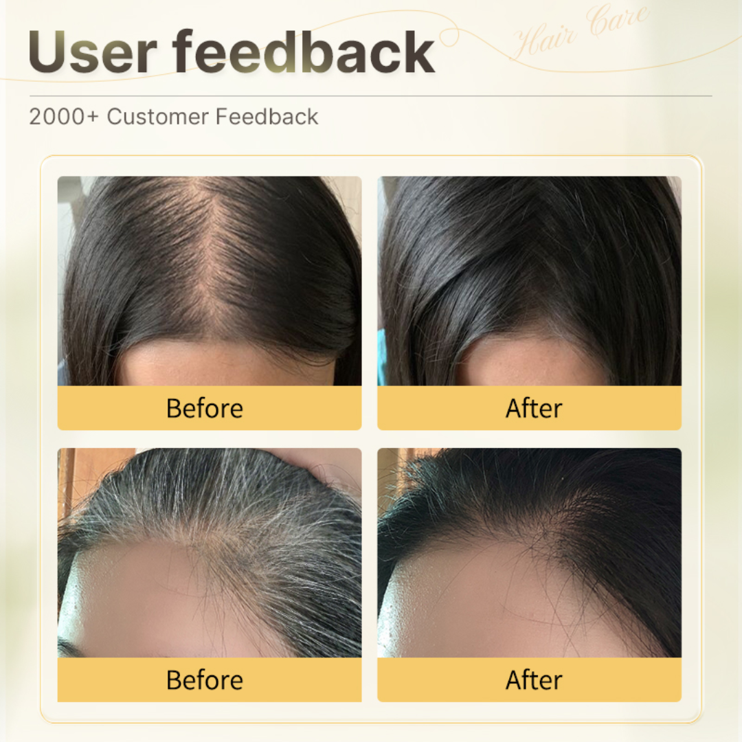 Proskire Anti-Grey Hair Serum | Reduces White Hair