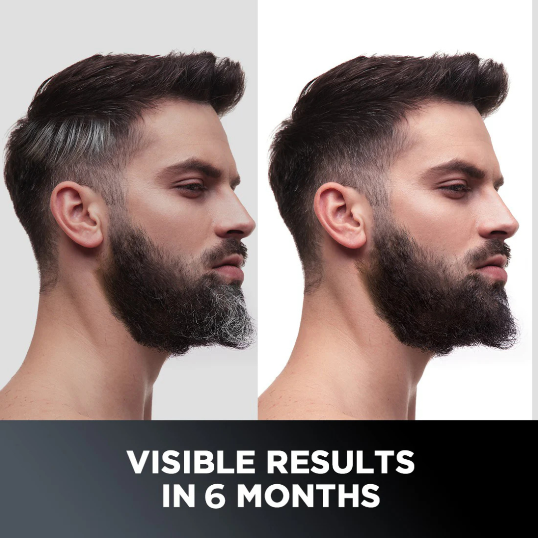 Proskire Anti-Grey Hair Serum | Reduces White Hair