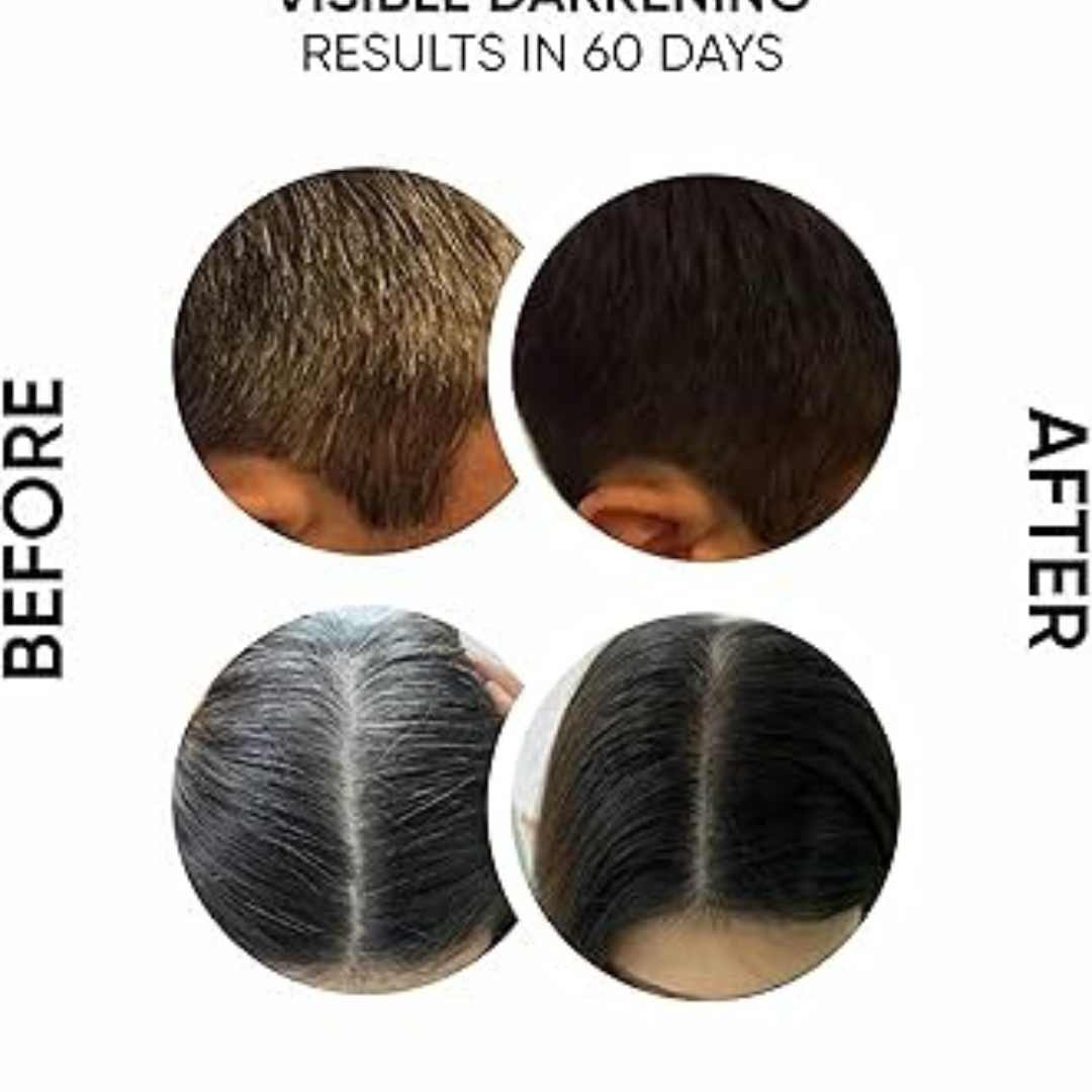 Proskire Anti-Grey Hair Serum | Reduces White Hair