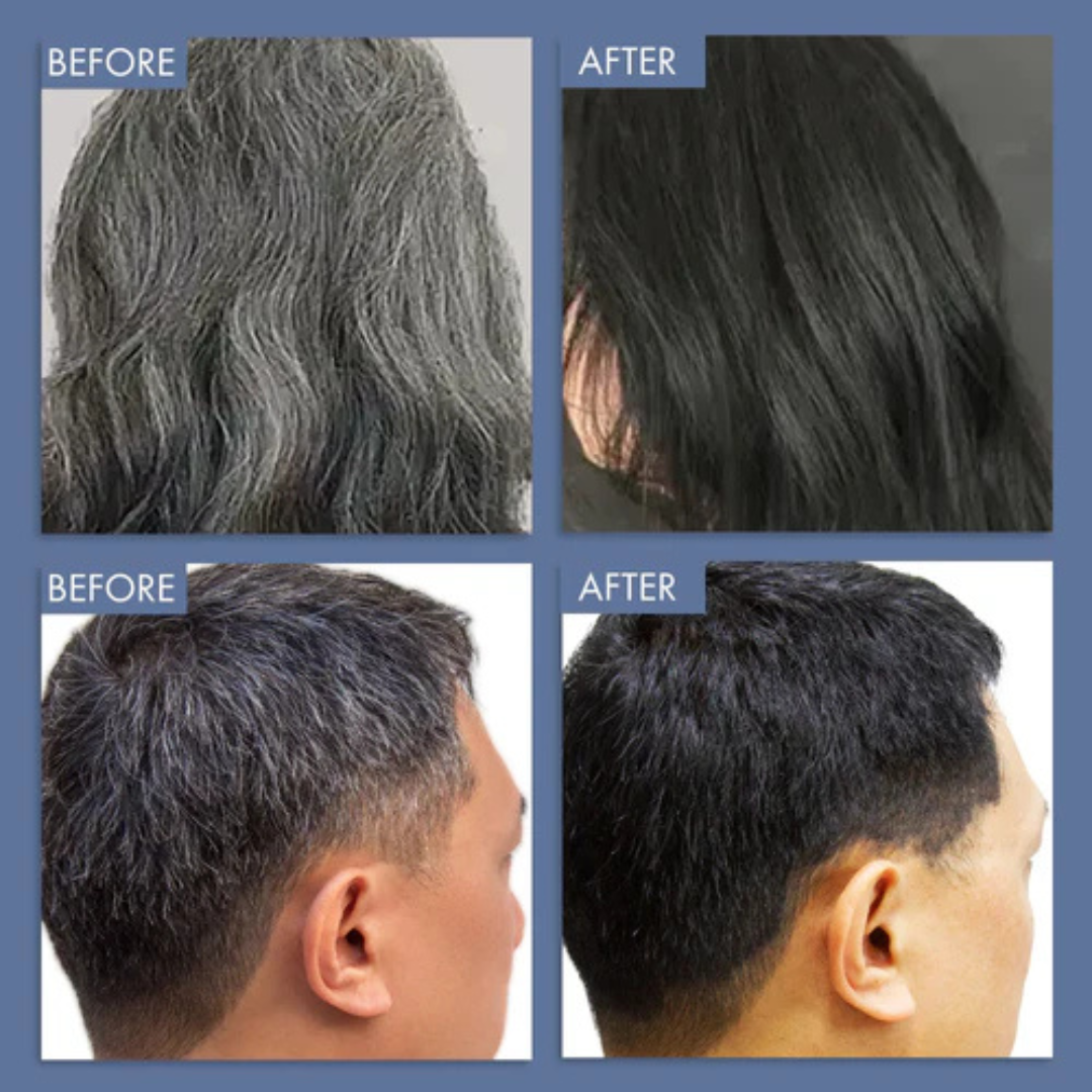 Proskire Anti-Grey Hair Serum | Reduces White Hair