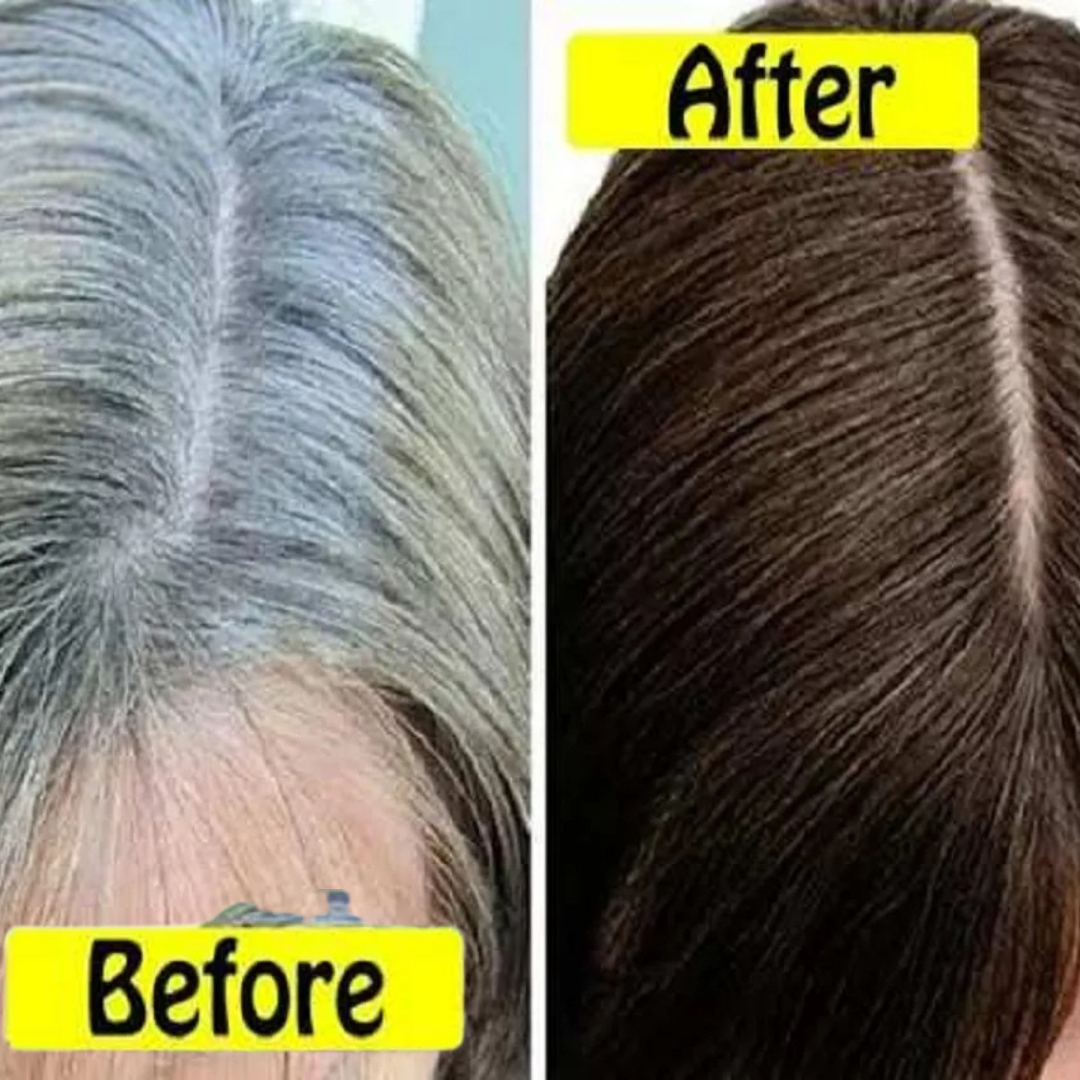 Proskire Anti-Grey Hair Serum | Reduces White Hair
