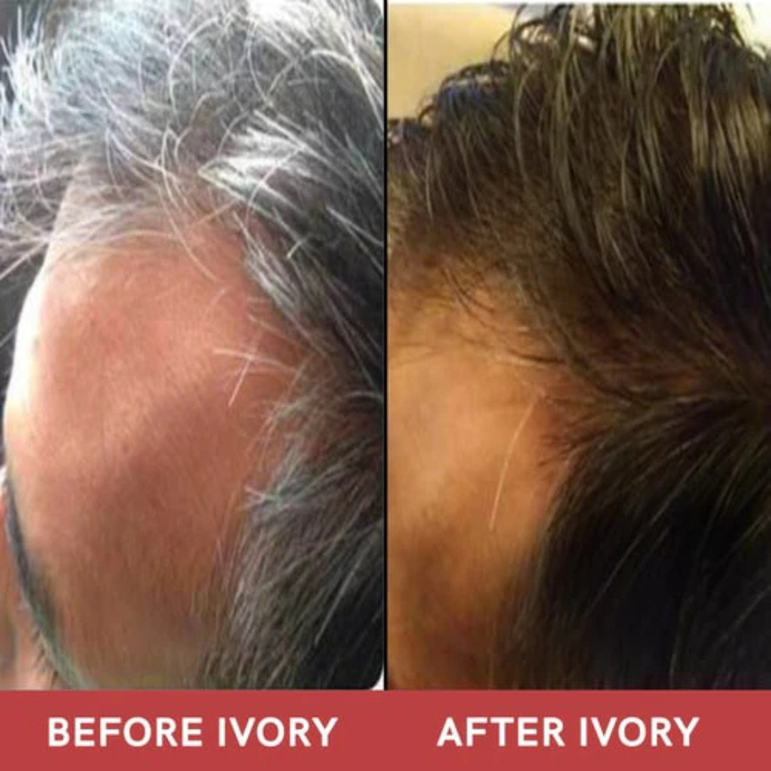 Proskire Anti-Grey Hair Serum | Reduces White Hair
