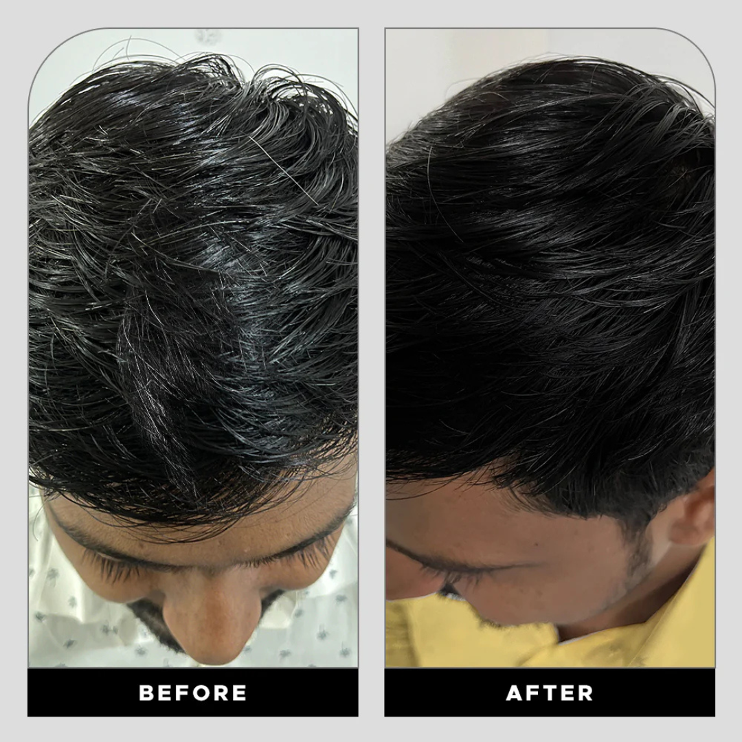 Proskire Anti-Grey Hair Serum | Reduces White Hair