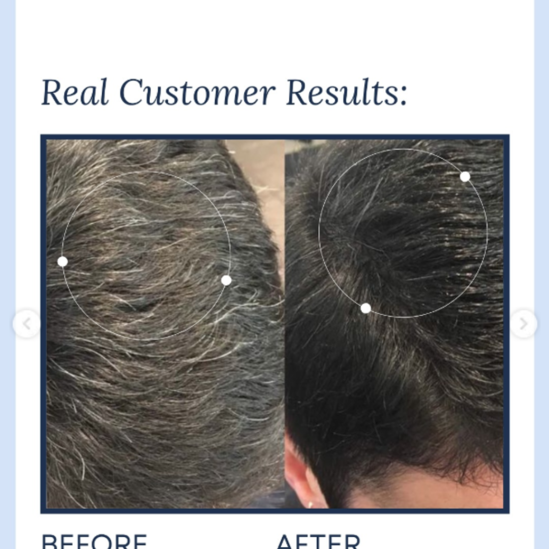 Proskire Anti-Grey Hair Serum | Reduces White Hair