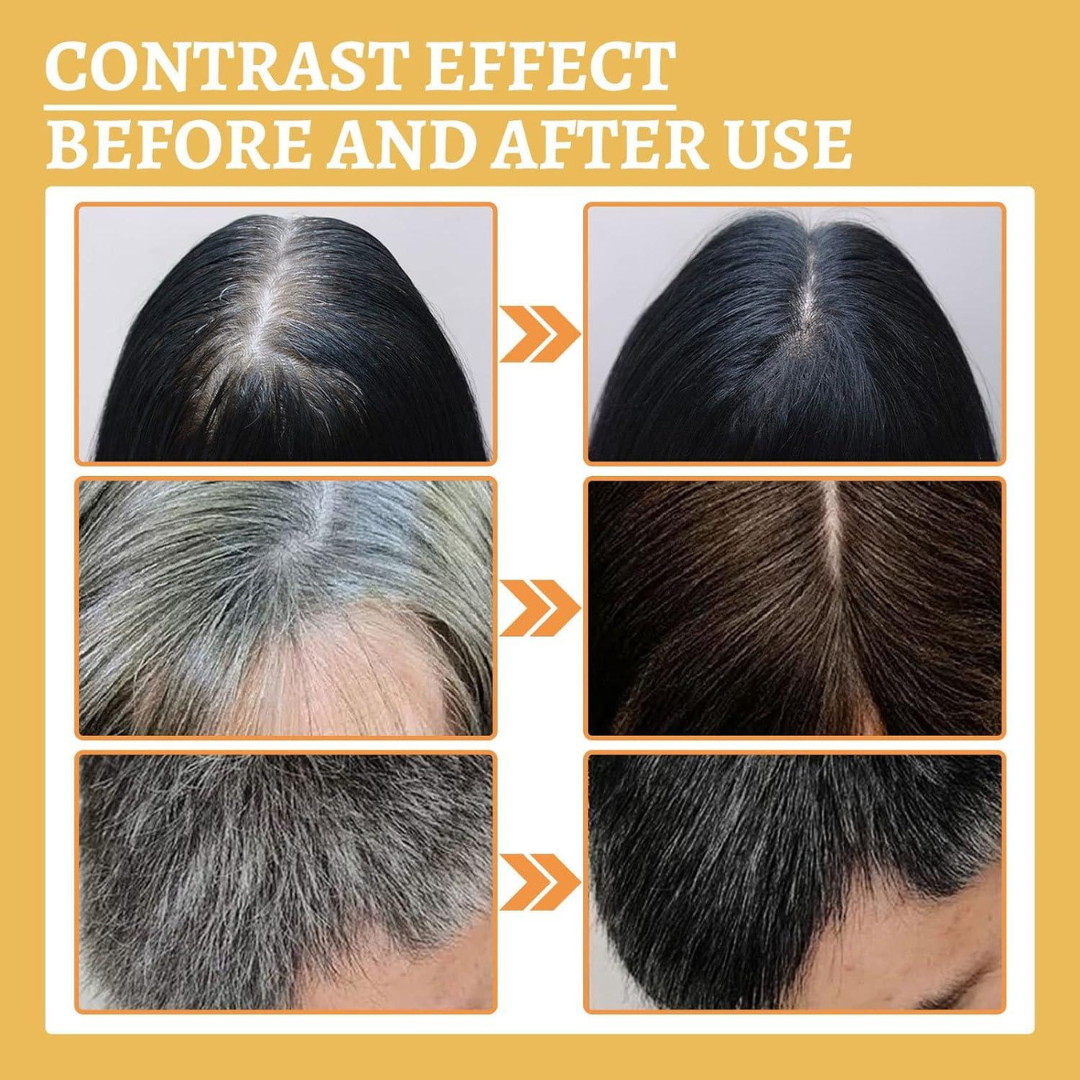 Proskire Anti-Grey Hair Serum | Reduces White Hair