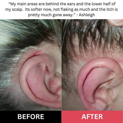 Nyra - Scalp Scrub