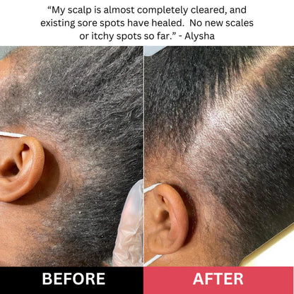 Nyra - Scalp Scrub