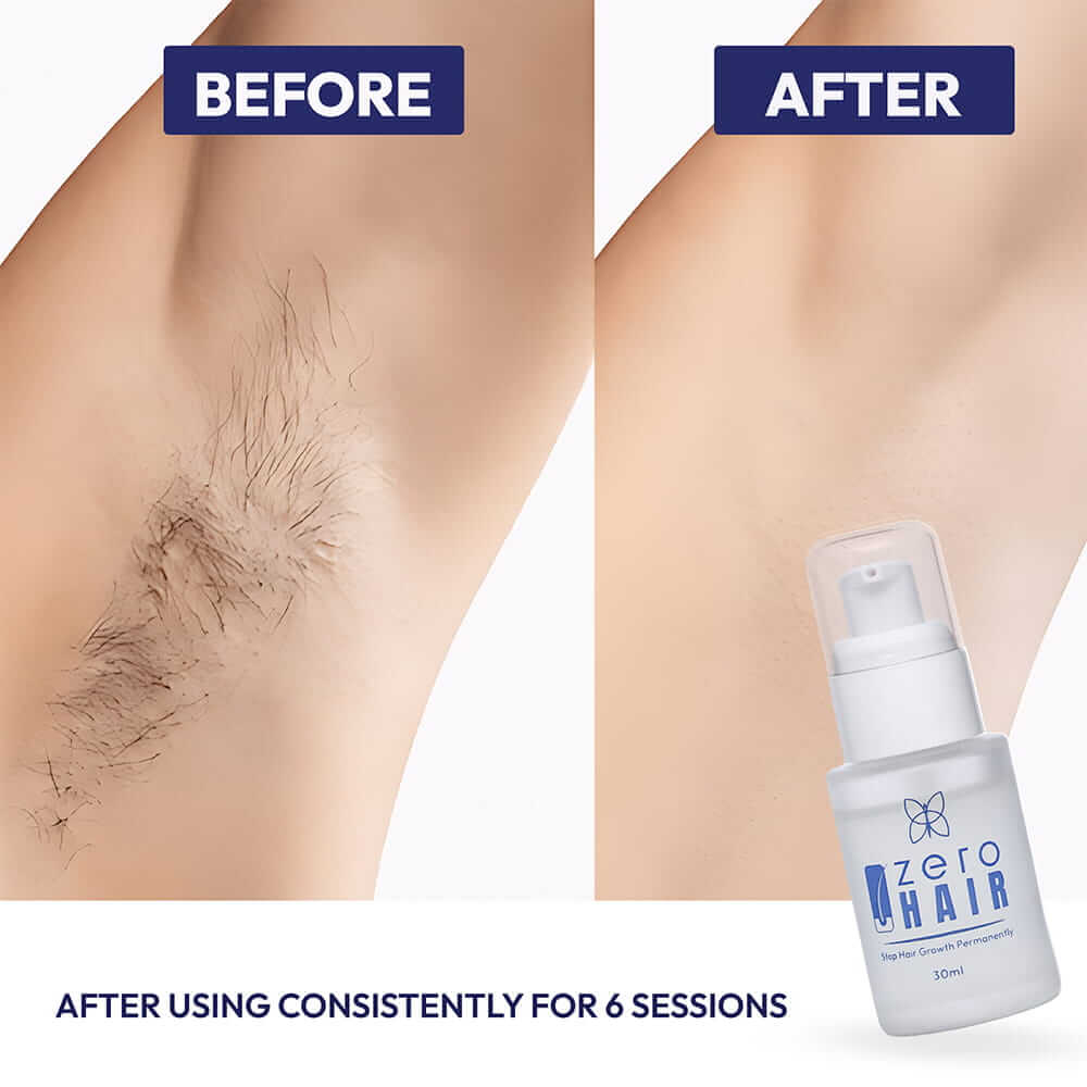 ZERO HAIR SERUM